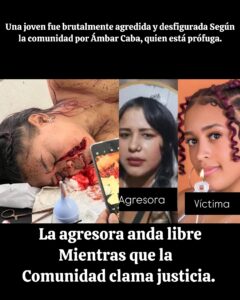 🚨 Indignación en Santiago: joven es brutalmente agredida y desfigurada; comunidad denuncia que la agresora está prófuga adolente
